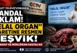 Çin Devlet Medyasında “Helal Organ” Skandalı: Doğu Türkistan Üzerinden Küresel Organ Ticareti Tartışması